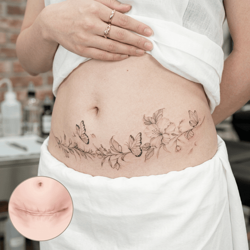 hình xăm che sẹo ở bụng
